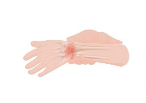 wrist pain